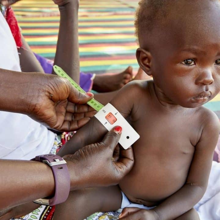 Adut est examiné pour la malnutrition aiguë à l'aide d'une bande MUAC au centre de nutrition de Gabat. © UNICEF/UN0344903/Wilson