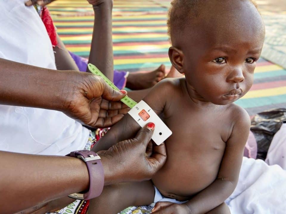 Adut est examiné pour la malnutrition aiguë à l'aide d'une bande MUAC au centre de nutrition de Gabat. © UNICEF/UN0344903/Wilson