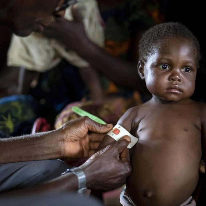 Le 13 octobre 2021, les membres de la Cellule d'Animation Communautaire de Kalemba Mulumba, un village situé à 15 km au sud de Kananga, en République démocratique du Congo, mesurent le périmètre barchial des enfants afin de détecter les cas de malnutrition. © UNICEF/UN0559934/Dubourthoumieu
