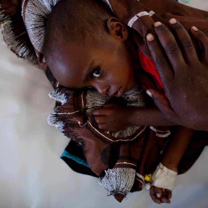 Abdi, 20 mois, est réconforté par sa mère à l'unité de stabilisation nutritionnelle soutenue par l'UNICEF à Burao, en Somalie, vendredi 10 mars 2017. Ils se sont rendus à Buarao depuis l'Éthiopie à cause de la sécheresse et avaient perdu tous leurs animaux ; la mère a dix autres enfants à sa charge. © UNICEF/UN057377/Holt
