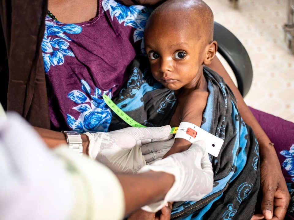 Le 5 février 2022, à l'hôpital de Dolow, en Somalie, le petit Salman Issak, 12 mois, se fait mesurer son périmètre brachial pendant que sa mère Maroogo Aden le tient dans ses bras. Selon l'indication rouge sur le ruban, Salman souffre de malnutrition aiguë sévère. ©UNICEF/UN0591211/Taxta