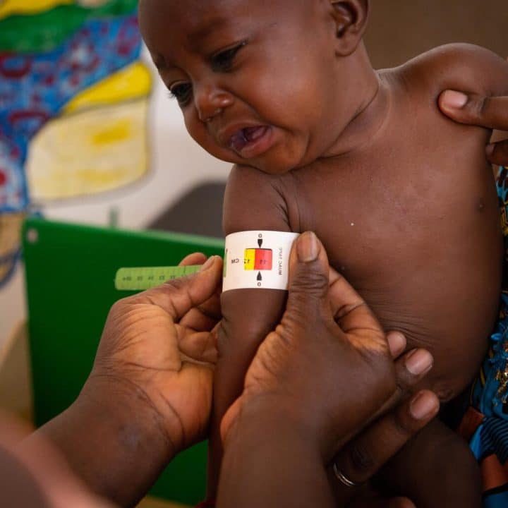 Le 21 juin 2022 au Centre de Santé de Promotion Sociale de Kaya, Burkina Faso, Sebgo Josaphat, qui souffre de malnutrition aiguë sévère, se fait mesurer la circonférence de la partie supérieure de son bras. © UNICEF/UN0660070/Cisse