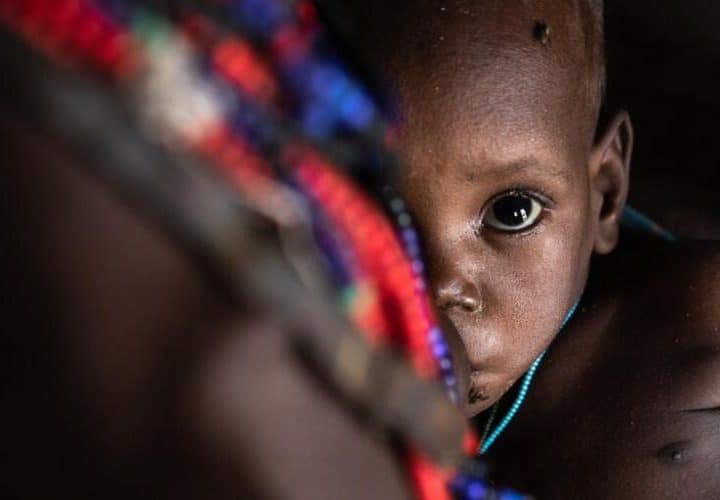 Un agent de santé réalise un dépistage sur l'un des bébés de Loyna qui souffre de malnutrition sévère.