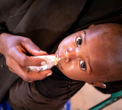 Somalie : Augmentation de la malnutrition aiguë sévère chez les enfants