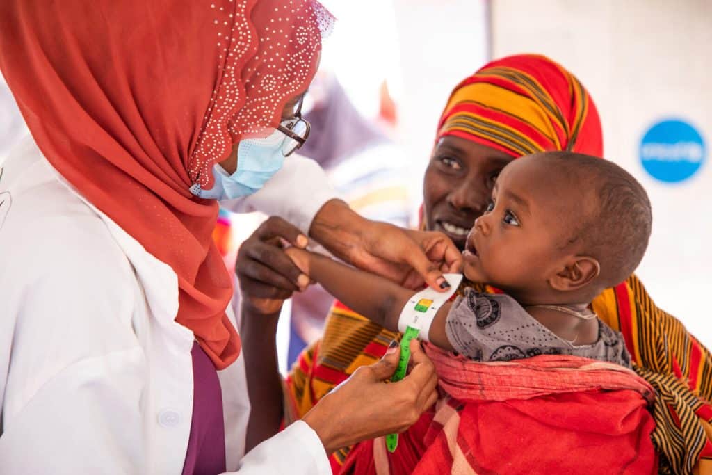 Un agent de santé mesure le bras d'un enfant pour évaluer son état nutritionnel, dans un camp de déplacés en Ethiopie.