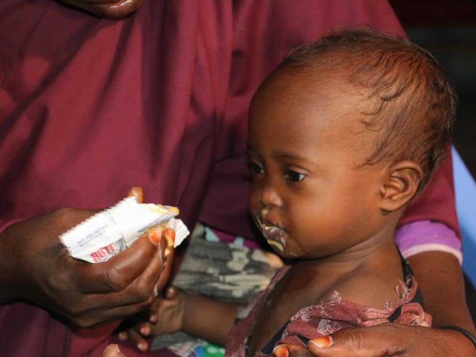 Le 4 octobre 2022, Sabirin, deux ans, se nourrit des aliments thérapeutiques prêts à l'emploi (RUTF) au centre de santé Weydow, soutenu par l'UNICEF, dans la banlieue de Mogadiscio, en Somalie. © UNICEF/UN0719755/Yusuf
