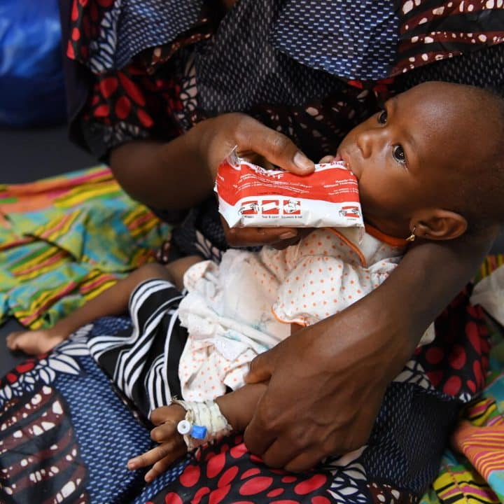 Plumpy nut malnutrition fillette Burkina Faso