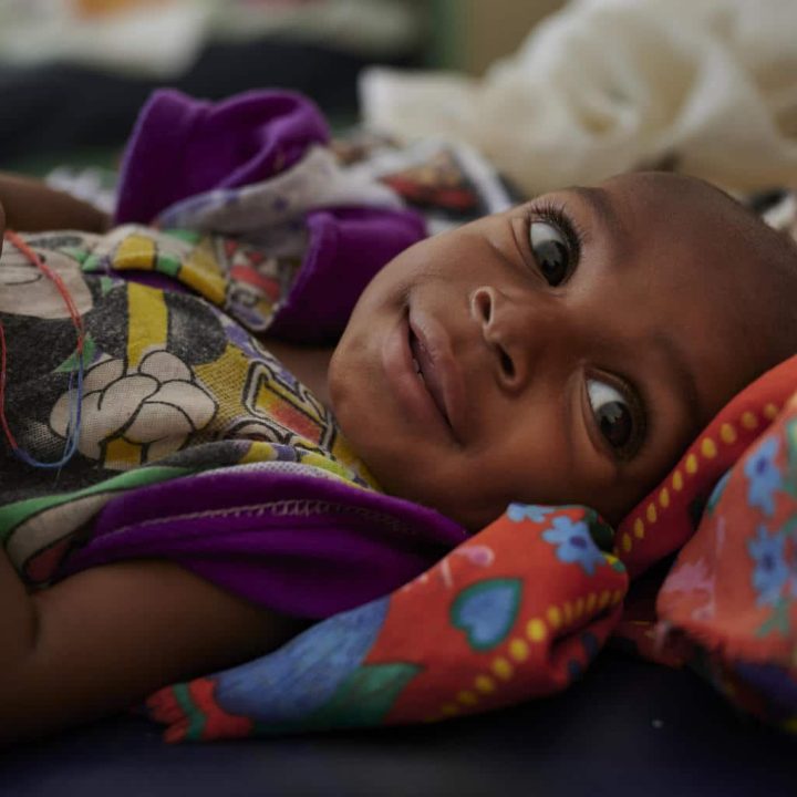 Ali Abubakar sourit alors qu'il se remet de la malnutrition sévère à l'hôpital de Damazin, soutenu par l'UNICEF, à Ad-Damazin, au Soudan. © UNICEF/UNI236401/Noorani