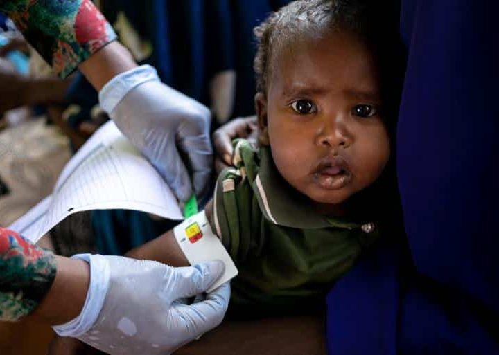 Au centre de santé de Dolow, en Somalie, le 3 février 2022, un soignant mesure le périmètre brachial d'un enfant pour évaluer les signes de malnutrition. ©UNICEF/UN0591135/Taxta
