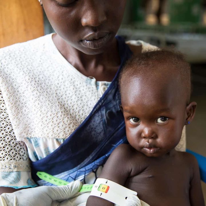 Afra, tenue par sa mère Therese, subit un contrôle de malnutrition à l'hôpital pour enfants Al Sabbah de Juba, au Sud-Soudan. © UNICEF/UN0232174/Njiokiktjien VII Photo