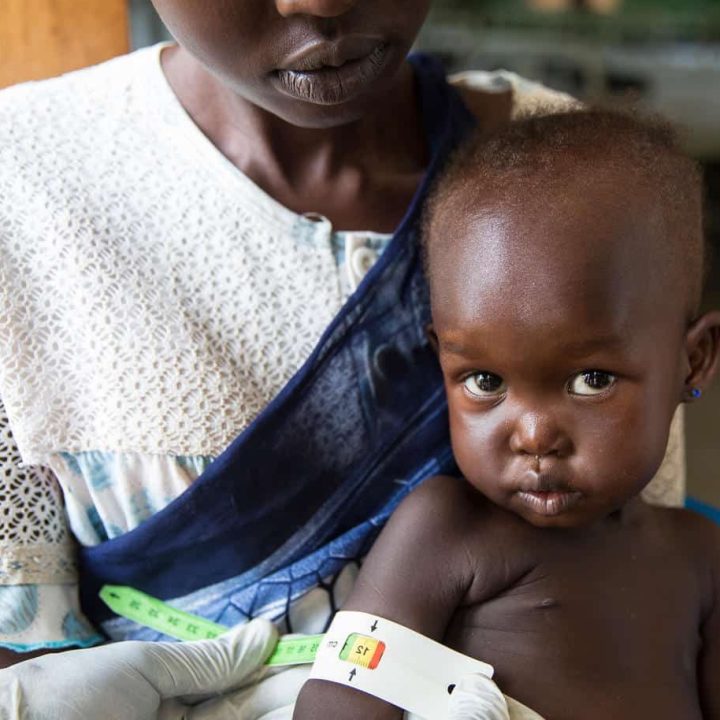 Afra, tenue par sa mère Therese, subit un contrôle de malnutrition à l'hôpital pour enfants Al Sabbah de Juba, au Sud-Soudan. © UNICEF/UN0232174/Njiokiktjien VII Photo