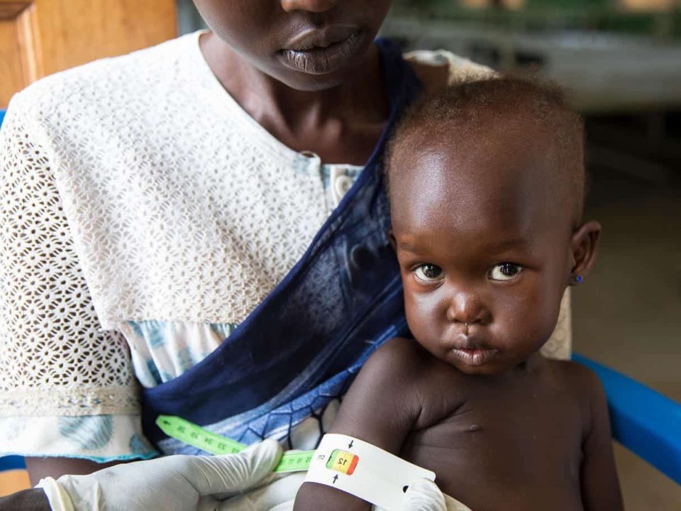 Afra, tenue par sa mère Therese, subit un contrôle de malnutrition à l'hôpital pour enfants Al Sabbah de Juba, au Sud-Soudan. © UNICEF/UN0232174/Njiokiktjien VII Photo
