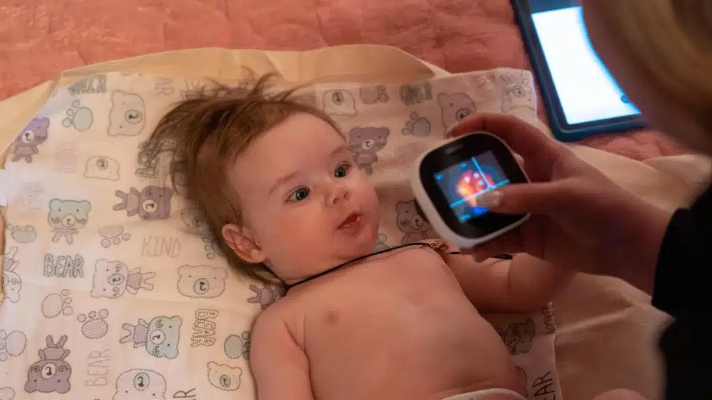 En Ukraine, Solomiia, 4 mois, bénéficie d'une visite médicale à domicile grâce au soutien de l'UNICEF© UNICEF/UNI519595/Vashkiv