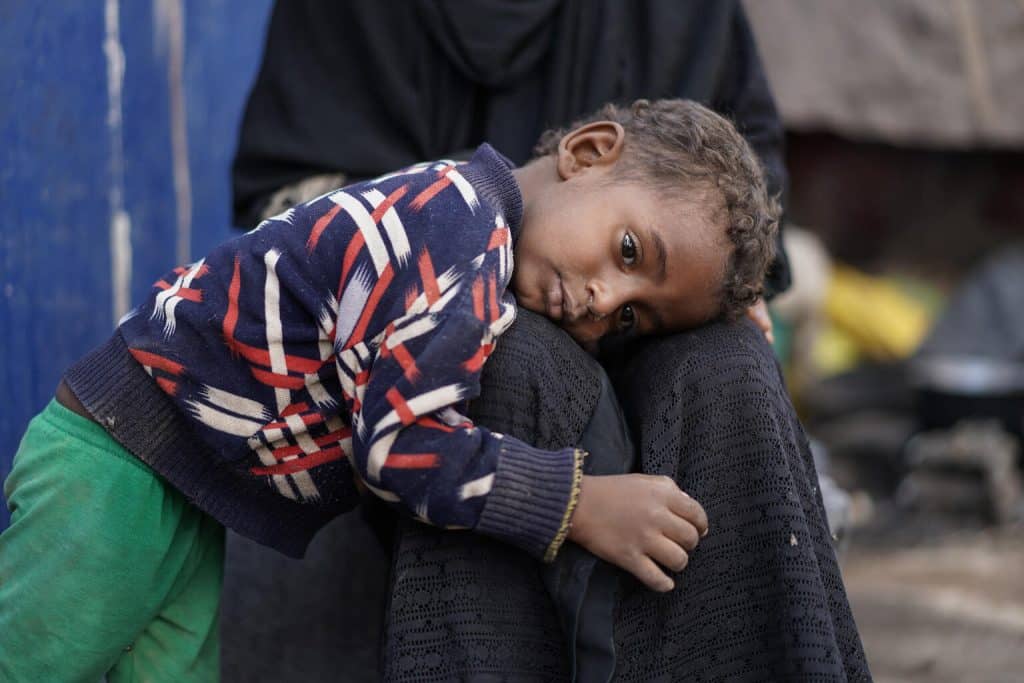 Le 9 février 2023, au Yémen, Ismail Abdo Ahmed, 2 ans, repose sur les genoux de sa mère, Fatima Muhammed Saeed, 35 ans. © UNICEF/UN0793365/Bin Hayan - YPN