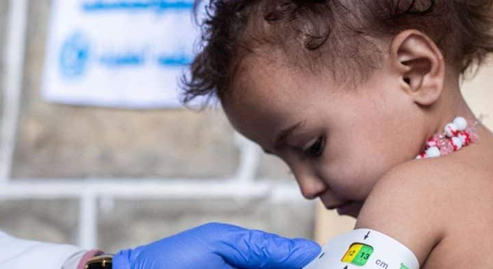 Un enfant fait l'objet d'un dépistage de l'émaciation sévère à l'aide d'un ruban de circonférence de la partie médiane du bras, dans une clinique mobile soutenue par l'UNICEF dans le district de Mazhar, dans le gouvernorat de Raymah, au Yémen. ⒸUNICEF Yemen/2022/Al-Haj