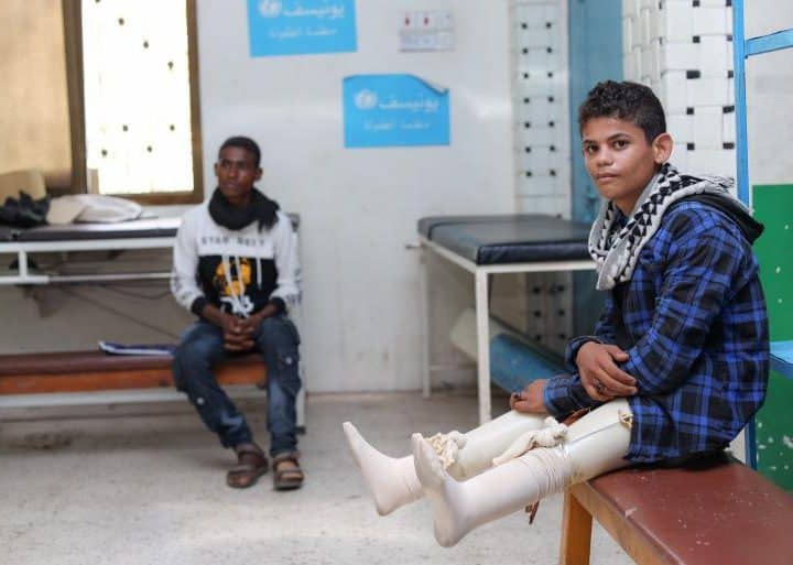Ibrahim porte ses prothèses dans le centre prosthétique d'Aden, au Yémen, le 14 octobre 2021. ©UNICEF/UN0538380
