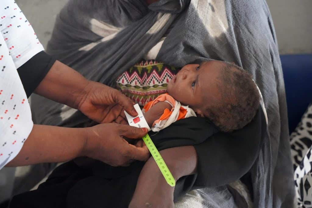 Alors que la guerre fait rage au Soudan, des millions d'enfants sont déplacés et les services de santé sont interrompus. Les taux de malnutrition aiguë sévère chez les enfants de moins de cinq ans explosent avec plus de 700 000 enfants souffrant de malnutrition aiguë sévère.© UNICEF/UNI409665/Awad