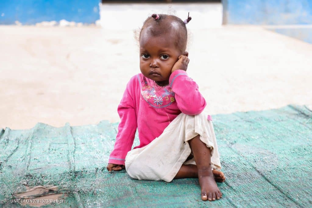Un enfant qui souffre de malnutrition photographié à l'unité de réhabilitation nutritionnelle de Bétou, en République démocratique du Congo. © UNICEF/UN0287523/Diefaga