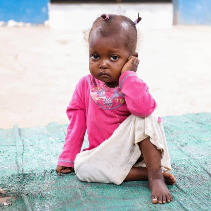 Un enfant qui souffre de malnutrition photographié à l'unité de réhabilitation nutritionnelle de Bétou, en République démocratique du Congo. © UNICEF/UN0287523/Diefaga