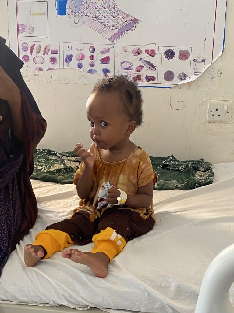 Au centre de réhabilitation nutritionnelle de Garowe, soutenu par l'UNICEF, de nombreux enfants atteints de malnutrition aigue sévère sont pris en charge. © UNICEF/Karine Guldemann