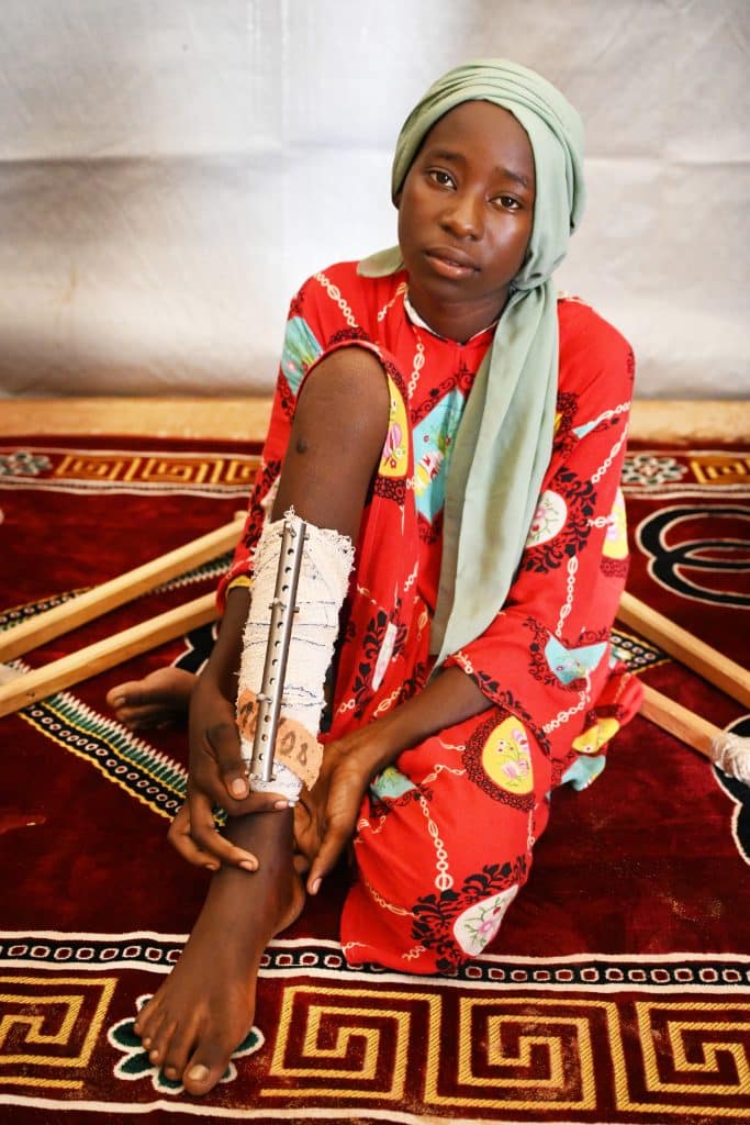 Fatna, 12 ans, est une réfugiée à Adré, dans l'est du Tchad. La jeune fille a été blessée par balles lors d'un échange de tirs dans son village au Soudan. © UNICEF/UNI425927/Dejongh