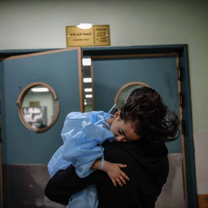 Ghazal, 4 ans, a été gravement blessée après le bombardement de sa maison. Un médecin de la maison voisine a pratiqué une opération de fortune sans anesthésie pour arrêter l'hémorragie. Après des jours d'épreuves, Ghazal a finalement atteint l'hôpital Nasser de Khan Yunis, où son pied infecté a été amputé. © UNICEF/UNI488721/Zaqout
