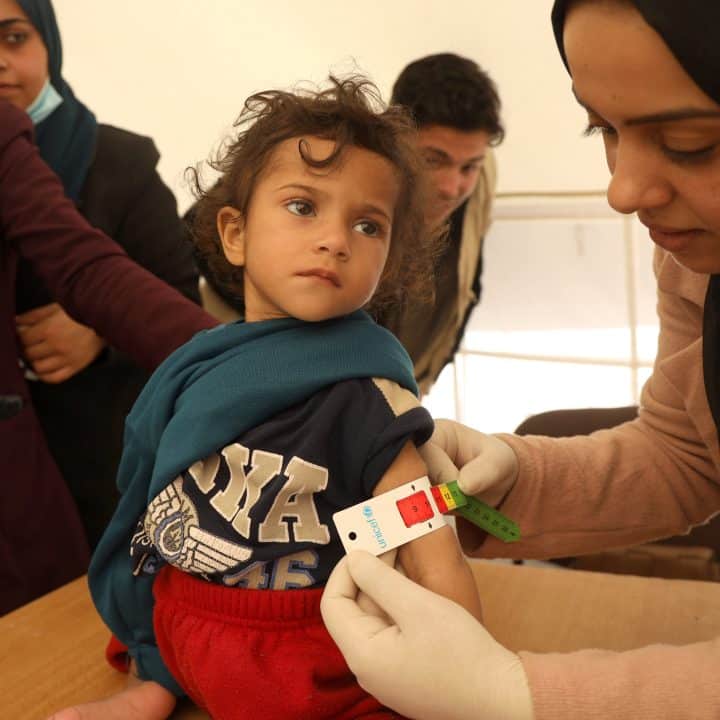 Leen, 2 ans, souffre de malnutrition aiguë sévère. Elle souffre d'une perte de poids et d'une atrophie musculaire drastiques. © UNICEF/UNI519940/El Baba