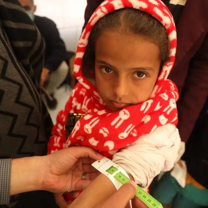 Amal, 4 ans, se fait mesurer le tour de bras dans le cadre d'un dépistage de la malnutrition dans une tente de clinique pédiatrique soutenue par l'UNICEF dans la ville de Rafah, au sud de la bande de Gaza. © UNICEF/UNI519950/El Baba