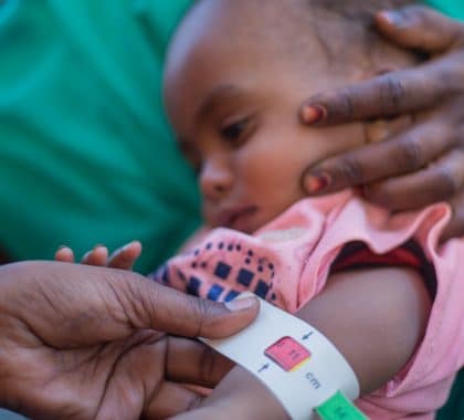 Soudan : les enfants confrontés à la malnutrition