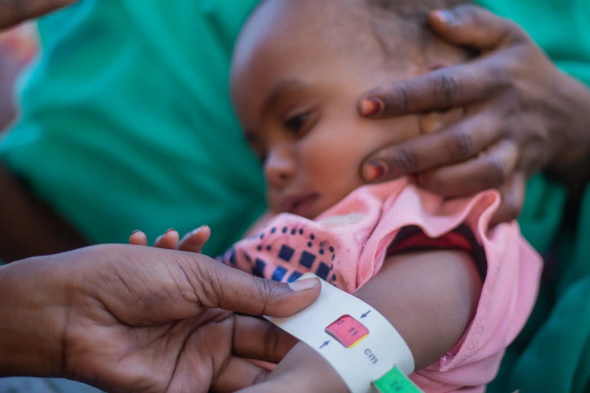 Au Soudan, Aida, 2 ans souffre de malnutrition et a besoin d'une prise en charge immédiate. Sa mère l'a donc emmenée dans un centre de santé soutenu par l'UNICEF © UNICEF/UNI529948/Mohamdeen