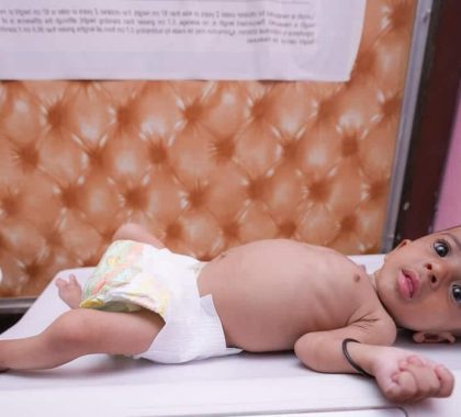 Yémen : 9 ans après le début du conflit, des millions d’enfants souffrent de malnutrition