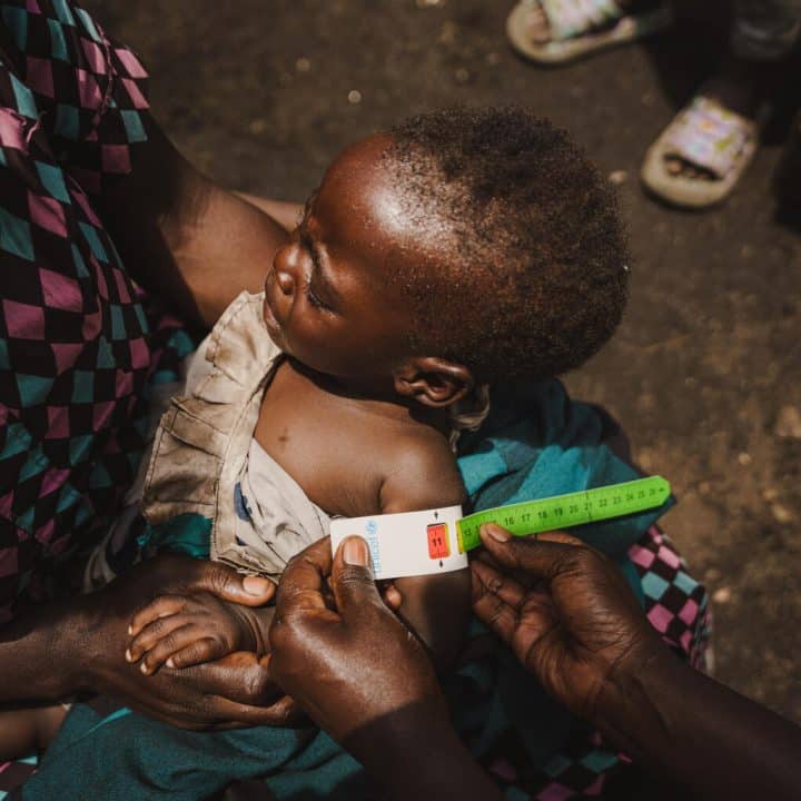 14-month-old Mwavita is screened for malnutrition in front of her shelter at the Lwashi IDP site in North Kivu province, DR Congo, March 12, 2024. © UNICEF/UNI539063/Benekire