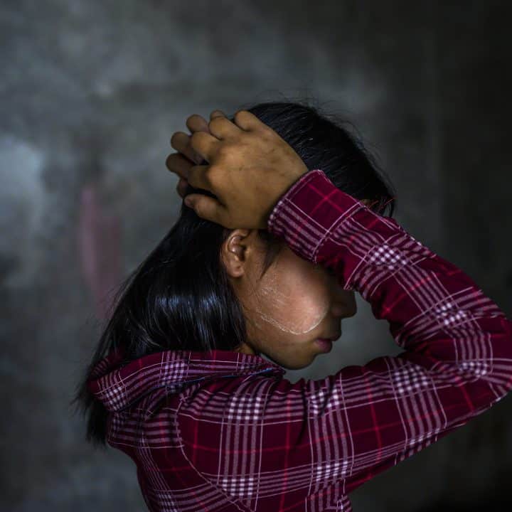 Naw Nee, une jeune fille de 14 ans de la région de Bago au Myanmar, porte les cicatrices d'une tragique explosion de mine terrestre. L'incident, qui a coûté la vie à son frère, s'est produit lorsque celui-ci a ramassé sans le savoir une mine terrestre, la prenant pour un jouet. ©UNICEF/UNI549345/Oo