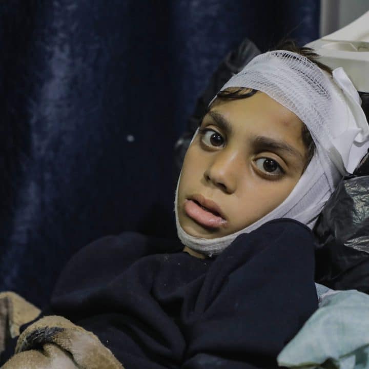 Dans la bande de Gaza, Ibrahim, 10 ans a été blessé lorsque son quartier a été la cible d'une opération militaire. © UNICEF/UNI774362/Nateel