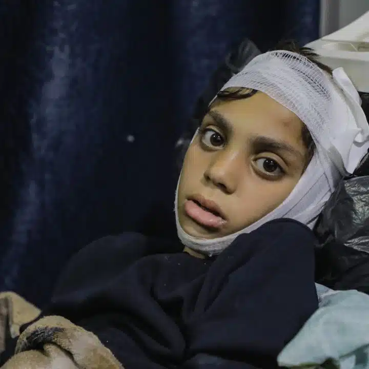 Dans la bande de Gaza, Ibrahim, 10 ans a été blessé lorsque son quartier a été la cible d'une opération militaire. © UNICEF/UNI774362/Nateel