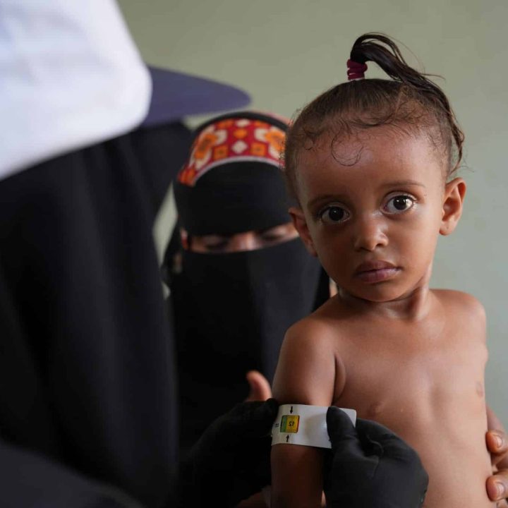Au Yémen, grâce au soutien de l'UNICEF, des enfants sont dépistés pour identifier les cas de malnutrition © UNICEF/UNI441659/Hayyan