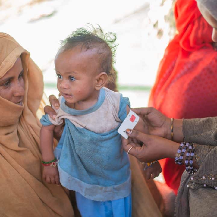 Aisha, 1 an, souffre de malnutrition aiguë sévère et nécessite un traitement immédiat. © UNICEF/UNI529921/Elfatih