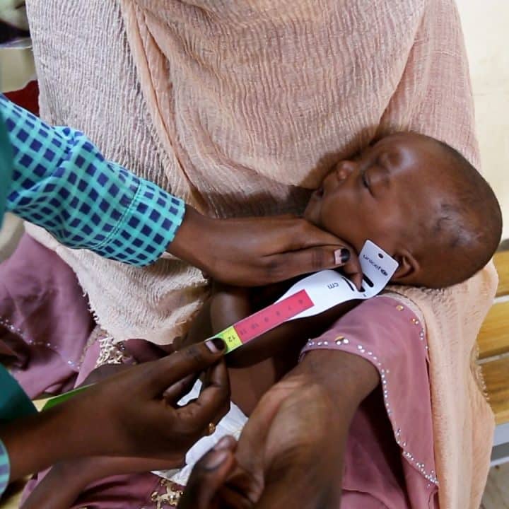 Un agent de santé de l'hôpital de Damazine, dans l'État du Nil Bleu au Soudan, examine Baraa, âgée de 6 mois et souffrant de malnutrition.© UNICEF/UNI593591/