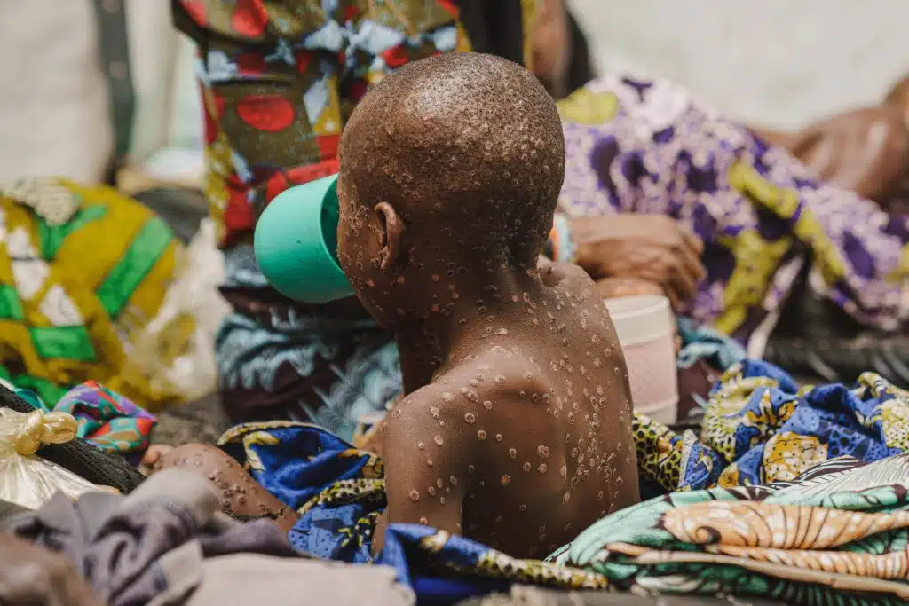 © UNICEF/UNI624808/Benekire