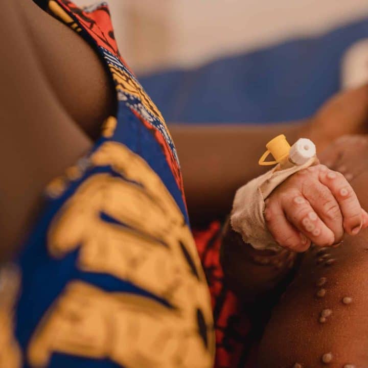 Aline*, 1 mois, dans les bras de sa mère à l'unité d'isolement Mpox de l'hôpital Kamanyola, soutenu par l'UNICEF, dans la province du Sud-Kivu, en RDC, le 24 juillet 2024. [*Prénom modifié] ©UNICEF/UNI624813/Benekire