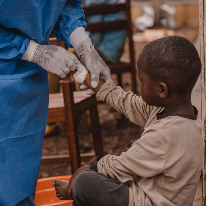 Mpox RDC vaccination variole