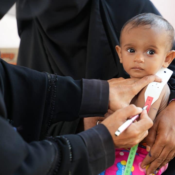 Au Yémen, un enfant souffrant de malnutrition est examiné par un agent de santé lors d'une visite de l'unité de soin mobile soutenue par l'UNICEF. © UNICEF/UNI708776/ALfilastini