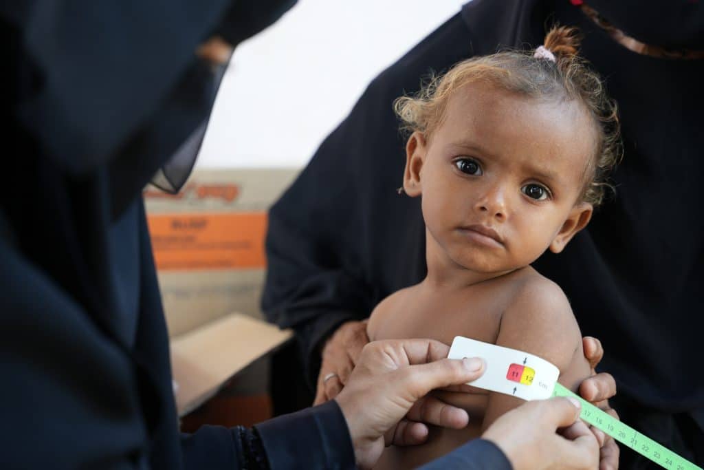 Au Yémen, l'UNICEF et ses partenaires mettent déploient des cliniques mobiles pour lutter contre les taux croissants de malnutrition. © UNICEF/UNI755539/
