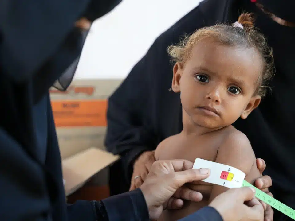 Au Yémen, l'UNICEF et ses partenaires mettent déploient des cliniques mobiles pour lutter contre les taux croissants de malnutrition. © UNICEF/UNI755539/