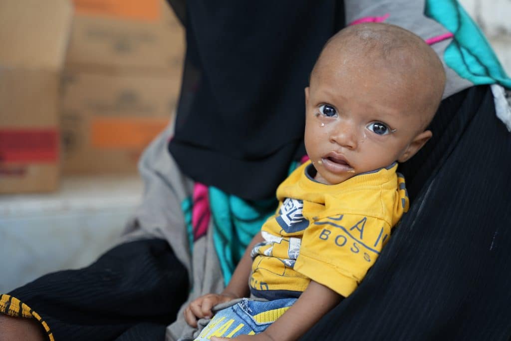Au Yémen, grâce au soutien de l'UNICEF, des enfants se font dépister pour identifier les cas de malnutrition. © UNICEF/UNI708808/ALfilastini