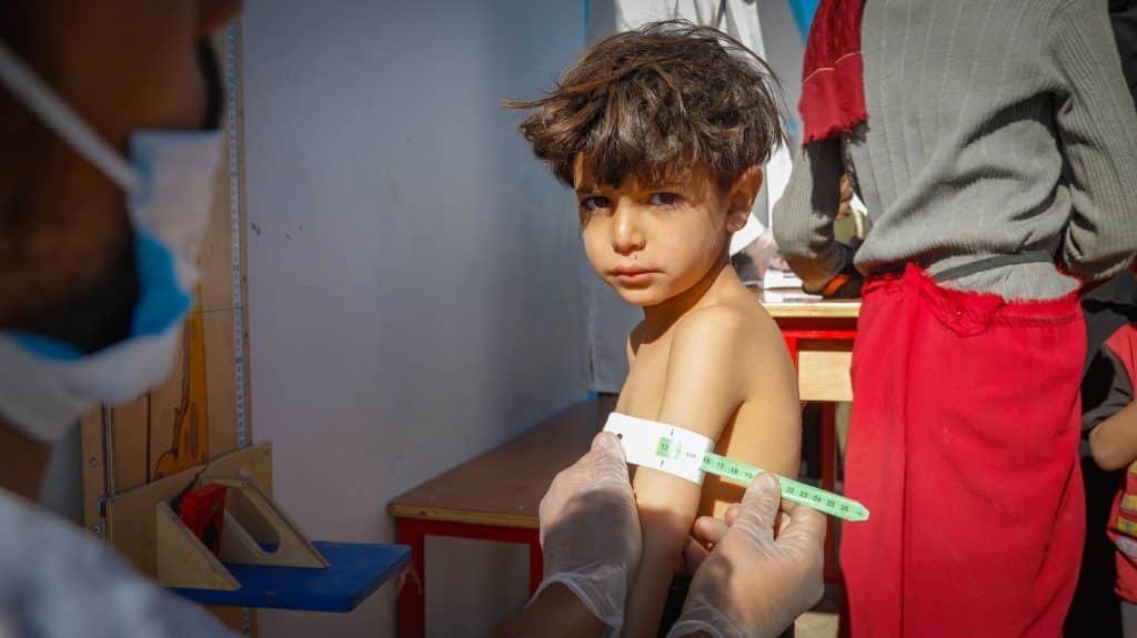 Adham, 4 ans, est l'un des enfants souffrant de malnutrition à Dhamar. Il reçoit un traitement à la clinique mobile de Dhamar, soutenue par l'UNICEF.© UNICEF/UNI736150/Haleem