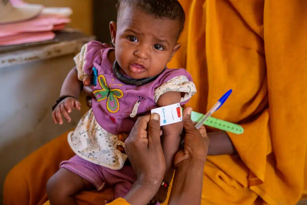 [Malnutrition - Soudan] Le 2 décembre 2024, dans l'État de Kassala au Soudan, Jamila a amené sa fille Amna au centre de santé. C'est grâce aux équipes de l'UNICEF que sa fille a été diagnostiquée et orientée vers le centre de santé le plus proche pour une prise en charge immédiate. © UNICEF/UNI707410/Rajab