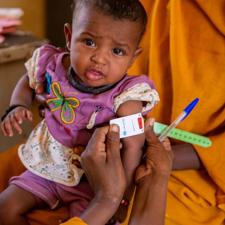 [Malnutrition - Soudan] Le 2 décembre 2024, dans l'État de Kassala au Soudan, Jamila a amené sa fille Amna au centre de santé. C'est grâce aux équipes de l'UNICEF que sa fille a été diagnostiquée et orientée vers le centre de santé le plus proche pour une prise en charge immédiate. © UNICEF/UNI707410/Rajab