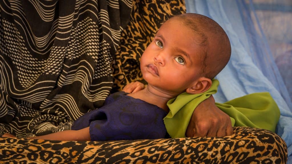 Faris,18 mois, se repose sur les genoux de sa mère en attendant son traitement contre la malnutrition. La sécheresse continue d'aggraver la situation nutritionnelle des enfants en Ethiopie. © UNICEF/UN059395/Ayene