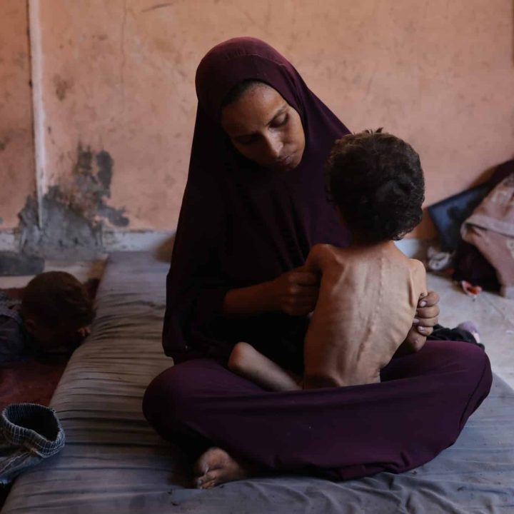 A Gaza, Yazan, âgé de deux ans et souffre de malnutrition sévère. Sa mère, Naima, déclare : « Nous n'avons pas reçu de farine ni aucune aide alimentaire depuis deux mois. »© UNICEF/UNI838252/El Baba